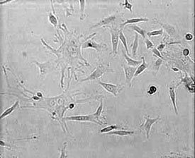 in vitro mouse bone marrow
