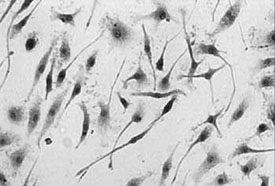 Neuroblasts