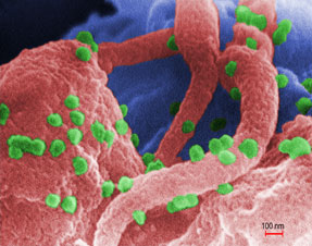 HIV HIV
